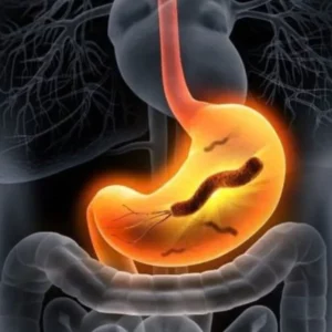 HP dạ dày là gì? HIỂU ĐÚNG về vi khuẩn Helicobacter pylori