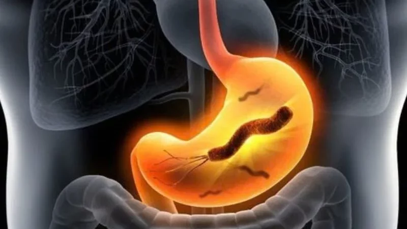 HP dạ dày là gì? HIỂU ĐÚNG về vi khuẩn Helicobacter pylori